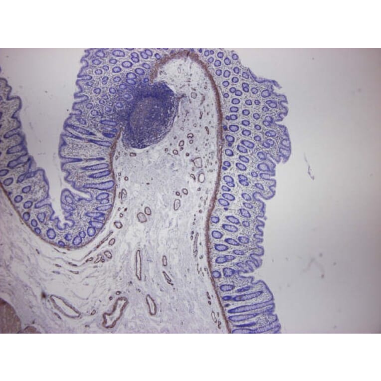 Immunohistochemistry - Anti-alpha Smooth Muscle Actin Antibody [HHF35] (A115508) - Antibodies.com