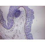 Immunohistochemistry - Anti-alpha Smooth Muscle Actin Antibody [HHF35] (A115508) - Antibodies.com