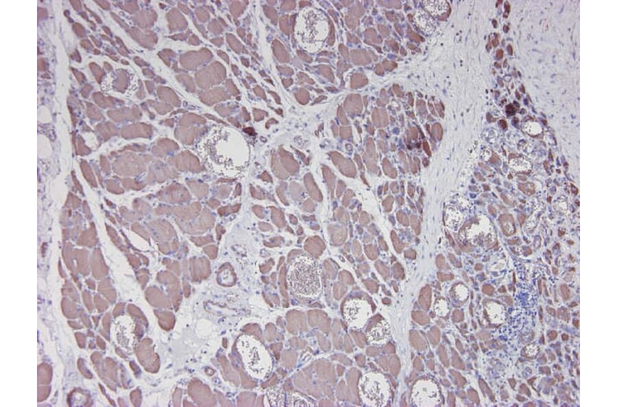 Immunohistochemistry - Anti-alpha Smooth Muscle Actin Antibody [HHF35] (A115508) - Antibodies.com