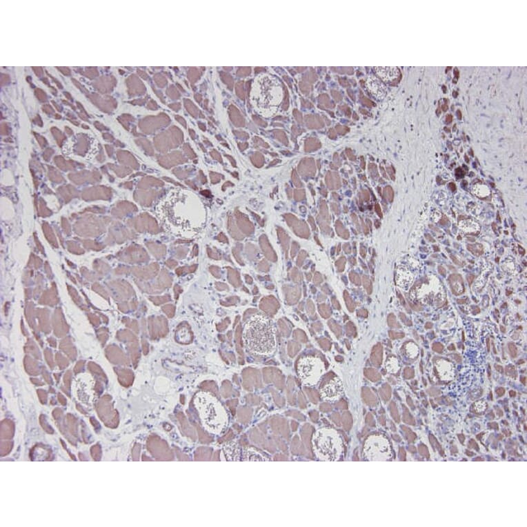Immunohistochemistry - Anti-alpha Smooth Muscle Actin Antibody [HHF35] (A115508) - Antibodies.com