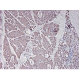Immunohistochemistry - Anti-alpha Smooth Muscle Actin Antibody [HHF35] (A115508) - Antibodies.com