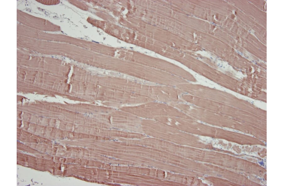 Immunohistochemistry - Anti-alpha Skeletal Muscle Actin Antibody [3B3] (A115509) - Antibodies.com