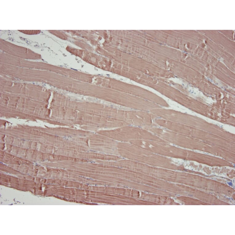 Immunohistochemistry - Anti-alpha Skeletal Muscle Actin Antibody [3B3] (A115509) - Antibodies.com