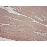Immunohistochemistry - Anti-alpha Skeletal Muscle Actin Antibody [3B3] (A115509) - Antibodies.com