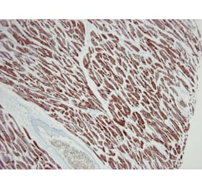 Immunohistochemistry - Anti-ACTC1 Antibody [22D3] (A115510) - Antibodies.com