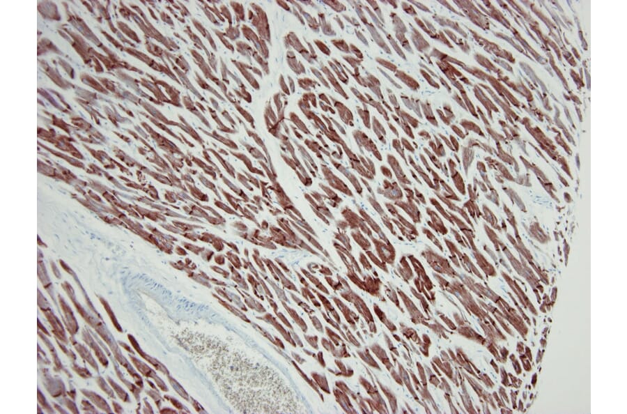 Immunohistochemistry - Anti-ACTC1 Antibody [22D3] (A115510) - Antibodies.com