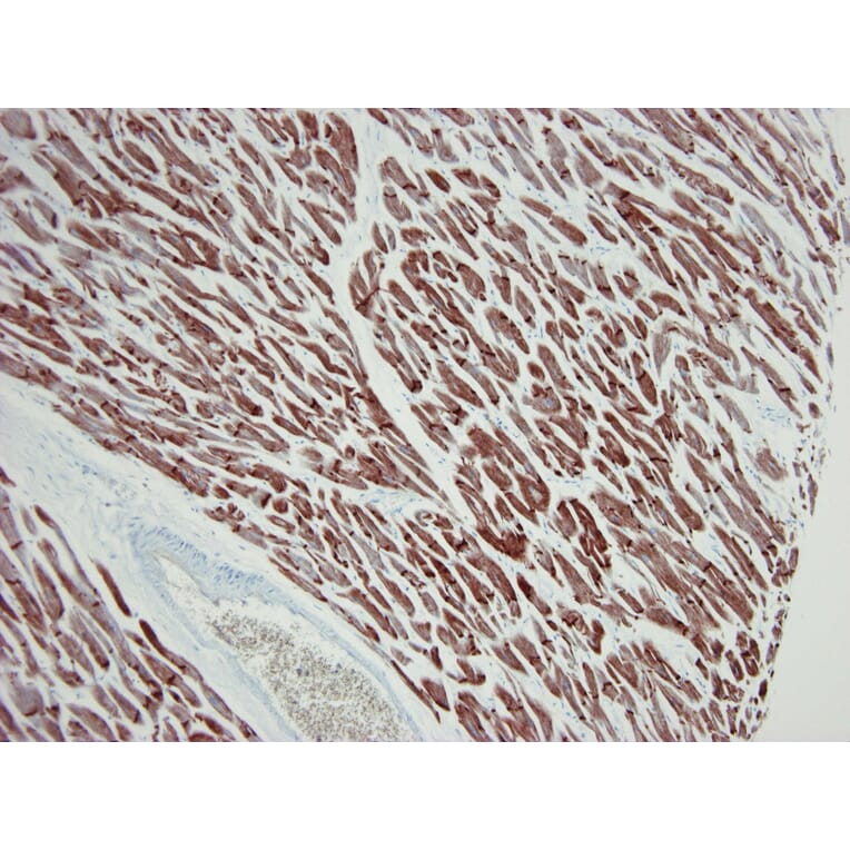 Immunohistochemistry - Anti-ACTC1 Antibody [22D3] (A115510) - Antibodies.com