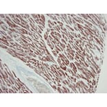 Immunohistochemistry - Anti-ACTC1 Antibody [22D3] (A115510) - Antibodies.com