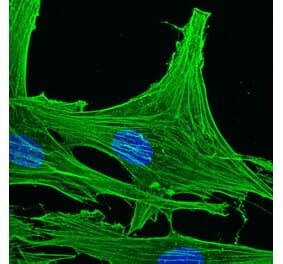 Immunohistochemistry - Anti-gamma Actin Antibody [2A3] (A115512) - Antibodies.com