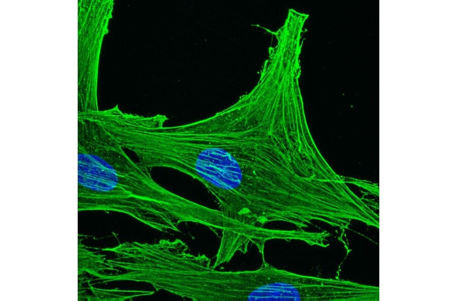 Immunohistochemistry - Anti-gamma Actin Antibody [2A3] (A115512) - Antibodies.com