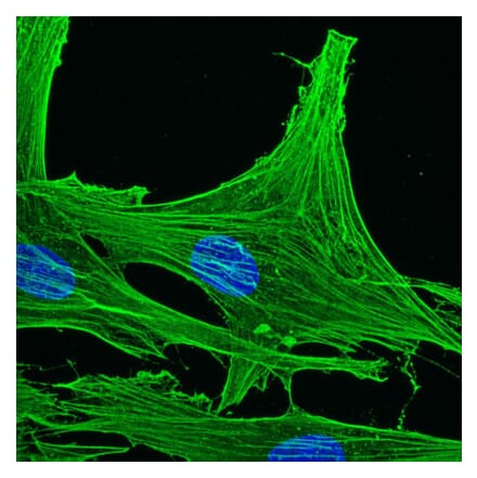 Immunohistochemistry - Anti-gamma Actin Antibody [2A3] (A115512) - Antibodies.com