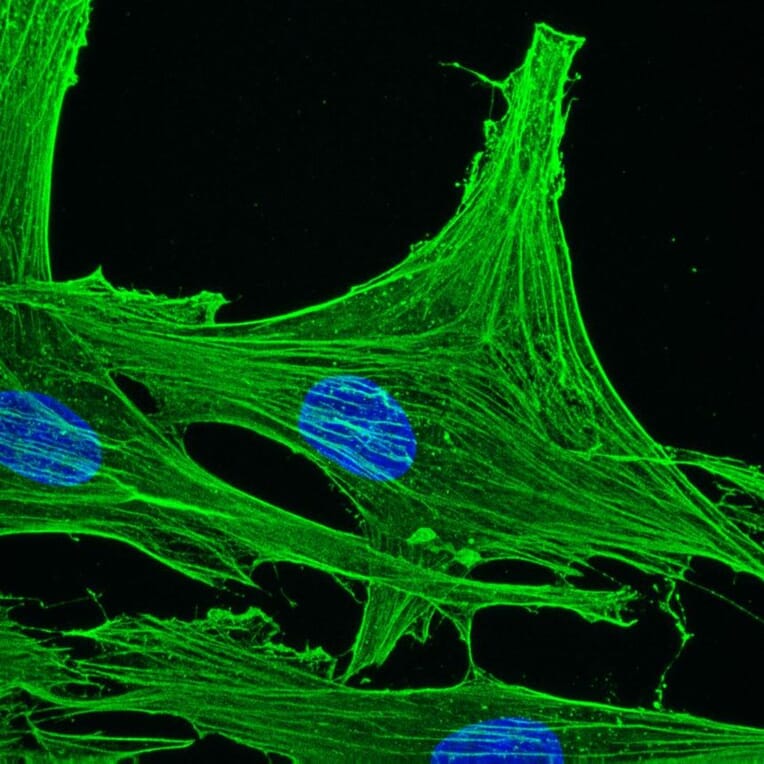 Immunohistochemistry - Anti-gamma Actin Antibody [2A3] (A115512) - Antibodies.com