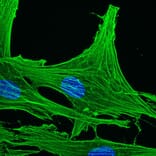 Immunohistochemistry - Anti-gamma Actin Antibody [2A3] (A115512) - Antibodies.com