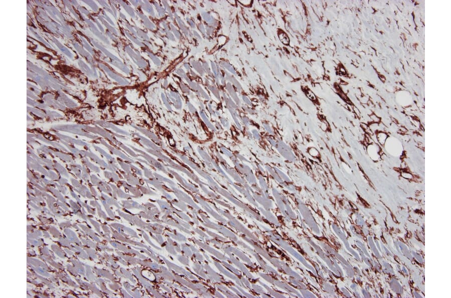Immunohistochemistry - Anti-gamma Actin Antibody [2A3] (A115512) - Antibodies.com