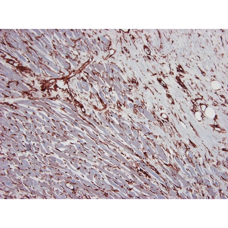 Immunohistochemistry - Anti-gamma Actin Antibody [2A3] (A115512) - Antibodies.com