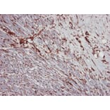 Immunohistochemistry - Anti-gamma Actin Antibody [2A3] (A115512) - Antibodies.com