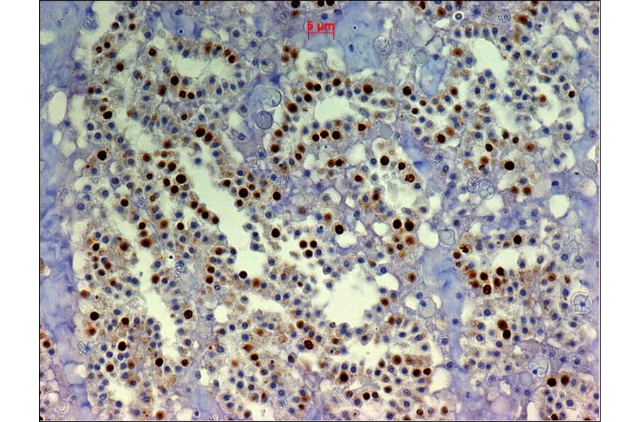 Immunohistochemistry - Anti-BrdU Antibody [IIB5] (A115514) - Antibodies.com