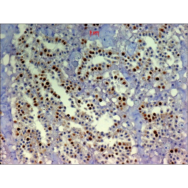Immunohistochemistry - Anti-BrdU Antibody [IIB5] (A115514) - Antibodies.com