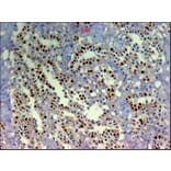 Immunohistochemistry - Anti-BrdU Antibody [IIB5] (A115514) - Antibodies.com