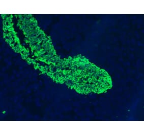 Immunofluorescence - Anti-Cytokeratin 5 + 8 Antibody [RCK102] (A115529) - Antibodies.com