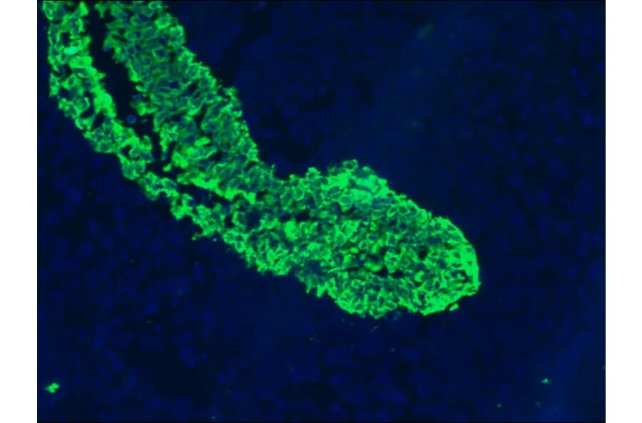 Immunofluorescence - Anti-Cytokeratin 5 + 8 Antibody [RCK102] (A115529) - Antibodies.com