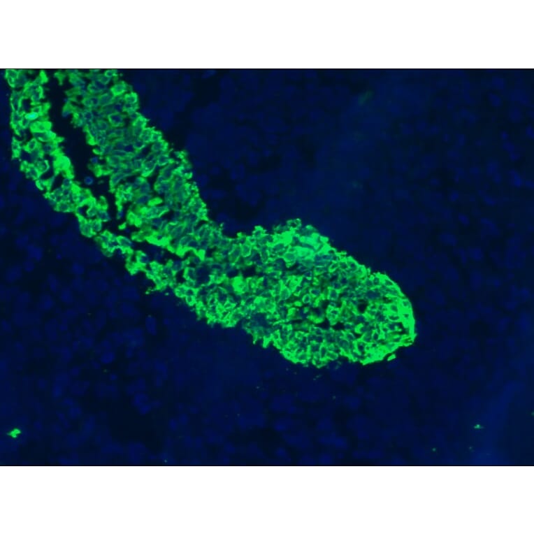 Immunofluorescence - Anti-Cytokeratin 5 + 8 Antibody [RCK102] (A115529) - Antibodies.com