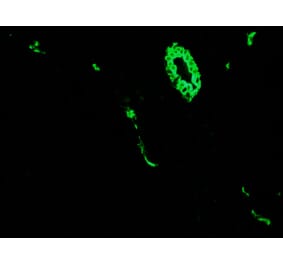 Immunohistochemistry - Anti-Cytokeratin 7 Antibody [RCK105] (A115530) - Antibodies.com