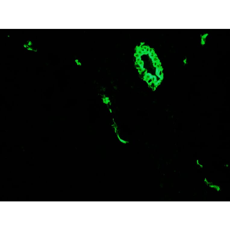 Immunohistochemistry - Anti-Cytokeratin 7 Antibody [RCK105] (A115530) - Antibodies.com