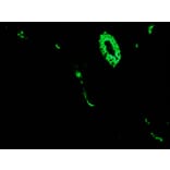 Immunohistochemistry - Anti-Cytokeratin 7 Antibody [RCK105] (A115530) - Antibodies.com