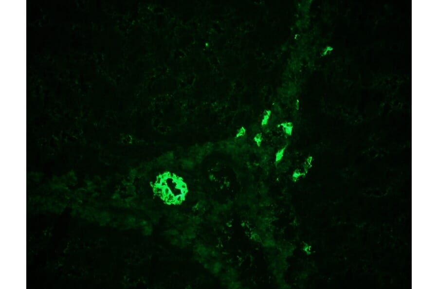 Immunohistochemistry - Anti-Cytokeratin 7 Antibody [RCK105] (A115530) - Antibodies.com