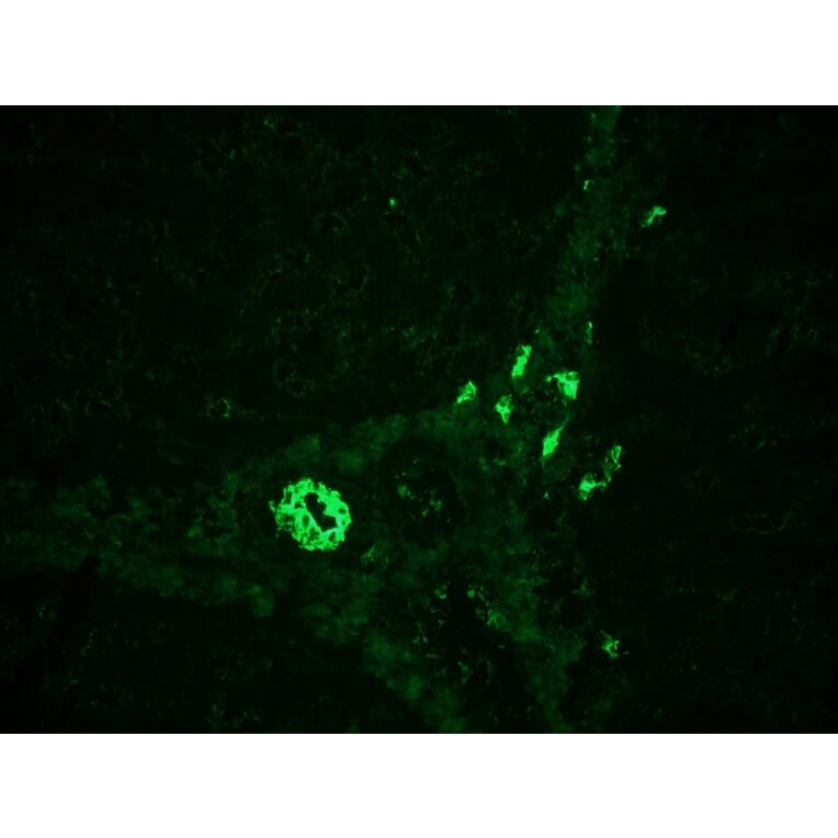 Immunohistochemistry - Anti-Cytokeratin 7 Antibody [RCK105] (A115530) - Antibodies.com