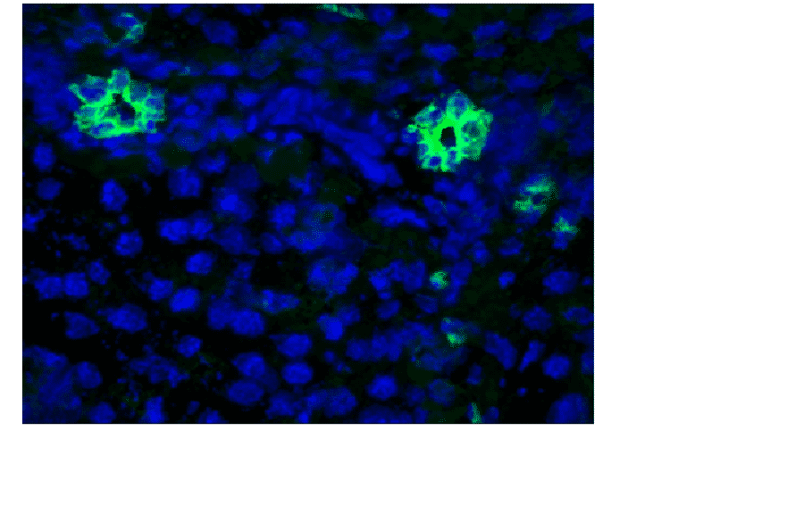 Immunohistochemistry - Anti-Cytokeratin 7 Antibody [RCK105] (A115530) - Antibodies.com