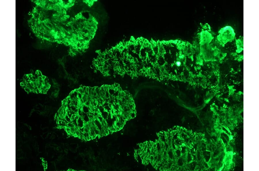 Immunohistochemistry - Anti-Cytokeratin 7 Antibody [RCK105] (A115530) - Antibodies.com