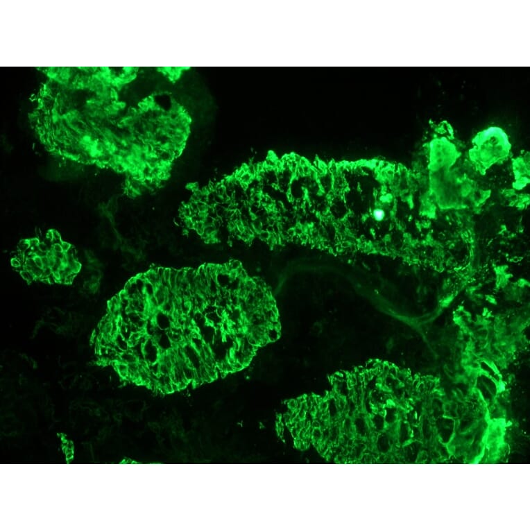 Immunohistochemistry - Anti-Cytokeratin 7 Antibody [RCK105] (A115530) - Antibodies.com
