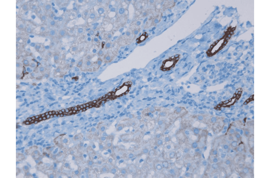 Immunohistochemistry - Anti-Cytokeratin 7 Antibody [RCK105] (A115530) - Antibodies.com