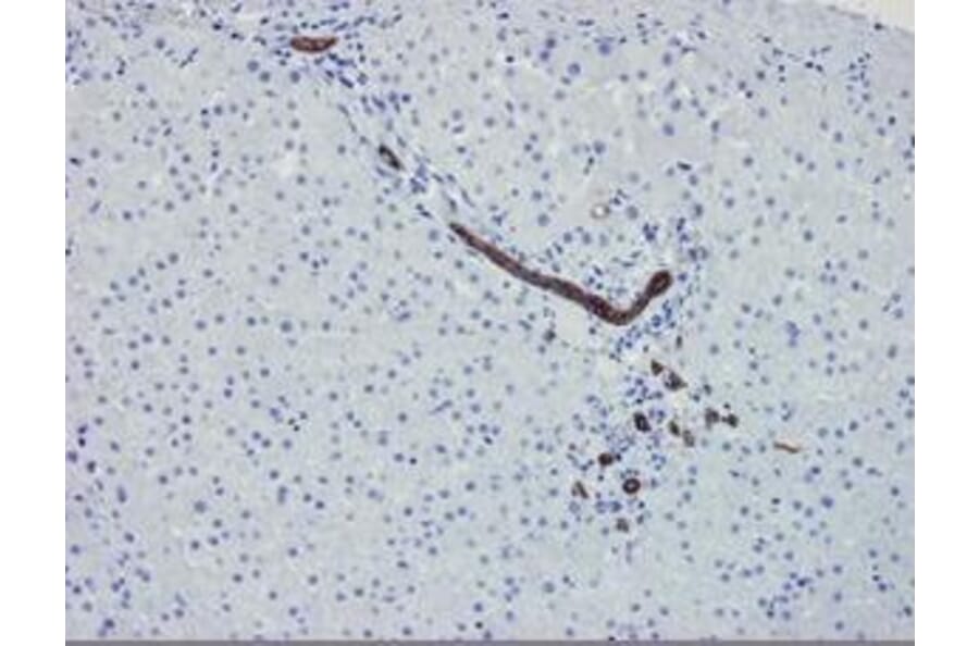 Immunohistochemistry - Anti-Cytokeratin 7 Antibody [OVTL12/30] (A115531) - Antibodies.com