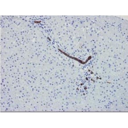 Immunohistochemistry - Anti-Cytokeratin 7 Antibody [OVTL12/30] (A115531) - Antibodies.com
