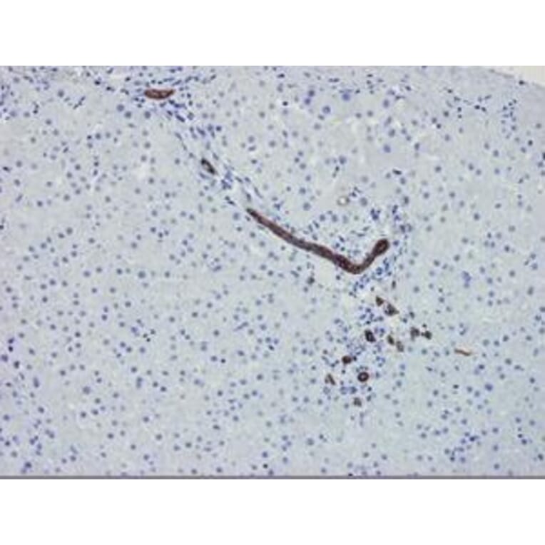 Immunohistochemistry - Anti-Cytokeratin 7 Antibody [OVTL12/30] (A115531) - Antibodies.com