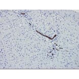 Immunohistochemistry - Anti-Cytokeratin 7 Antibody [OVTL12/30] (A115531) - Antibodies.com