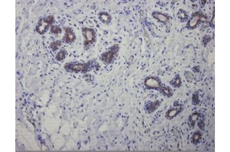Immunohistochemistry - Anti-Cytokeratin 7 Antibody [OVTL12/30] (A115531) - Antibodies.com