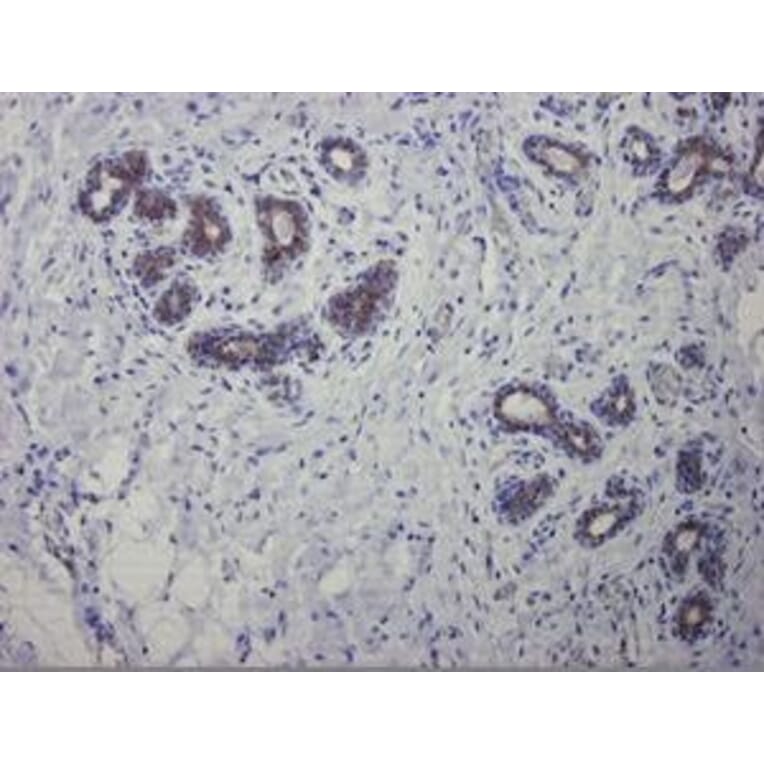 Immunohistochemistry - Anti-Cytokeratin 7 Antibody [OVTL12/30] (A115531) - Antibodies.com