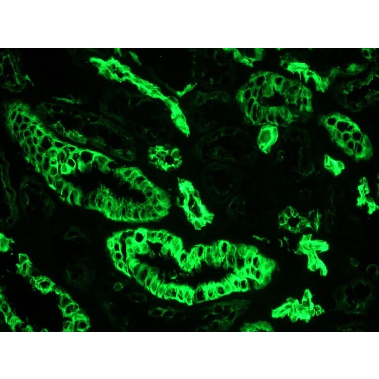 Immunohistochemistry - Anti-Cytokeratin 7 Antibody [OVTL12/30] (A115531) - Antibodies.com
