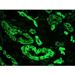 Immunohistochemistry - Anti-Cytokeratin 7 Antibody [OVTL12/30] (A115531) - Antibodies.com