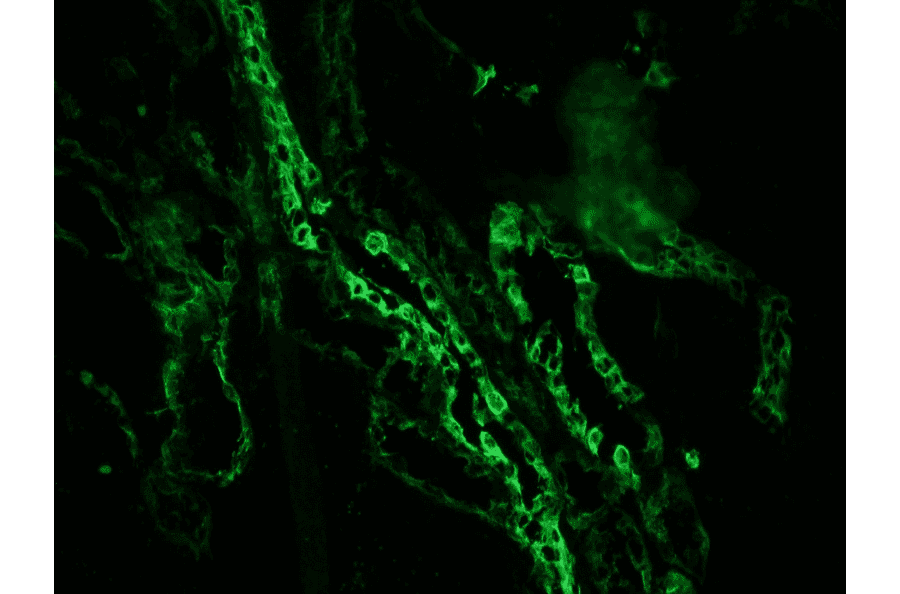 Immunofluorescence - Anti-Cytokeratin 7 Antibody [OVTL12/30] (A115531) - Antibodies.com