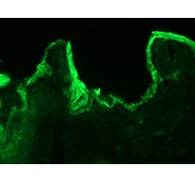 Immunohistochemistry - Anti-Cytokeratin 10 Antibody [DE-K10] (A115535) - Antibodies.com