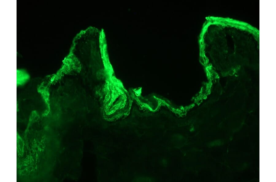 Immunohistochemistry - Anti-Cytokeratin 10 Antibody [DE-K10] (A115535) - Antibodies.com