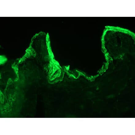 Immunohistochemistry - Anti-Cytokeratin 10 Antibody [DE-K10] (A115535) - Antibodies.com