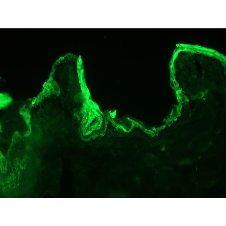Immunohistochemistry - Anti-Cytokeratin 10 Antibody [DE-K10] (A115535) - Antibodies.com