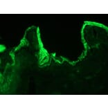 Immunohistochemistry - Anti-Cytokeratin 10 Antibody [DE-K10] (A115535) - Antibodies.com
