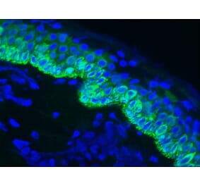 Immunofluorescence - Anti-Cytokeratin 14 Antibody [RCK107] (A115538) - Antibodies.com
